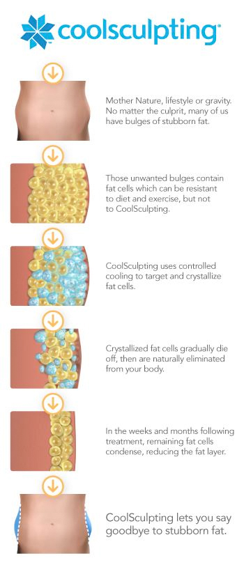 CoolSculpting Evansville, Indiana